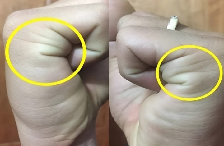 Hand